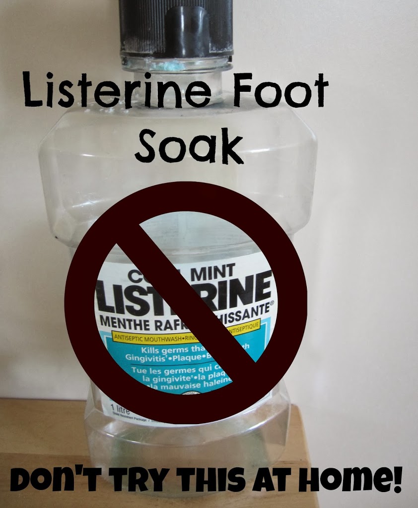 listerine to soften feet
